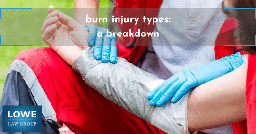 treating a burn injury - burn injury types